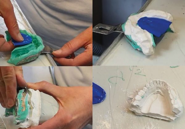 Gypsiform Lower Jaw Inserts
